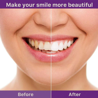 SmileKit™ V34 Teeth Whitening Purple Toothpaste